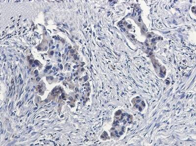 Immunohistochemistry-Paraffin: BubR1 Antibody (S05-3G7) [NBP3-19840]
