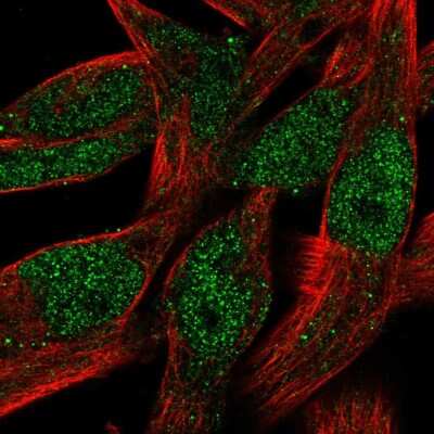 Immunocytochemistry/ Immunofluorescence: Buster3 Antibody [NBP1-91707]