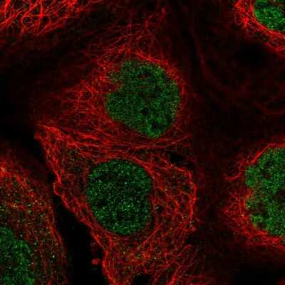 Immunocytochemistry/ Immunofluorescence: Buster3 Antibody [NBP2-58255]