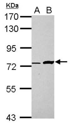 Western Blot: Buster3 Antibody [NBP2-15630]