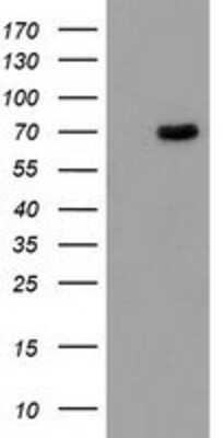 Western Blot: Butyrylcholinesterase/BCHE Antibody (OTI1E1) [NBP2-03523]
