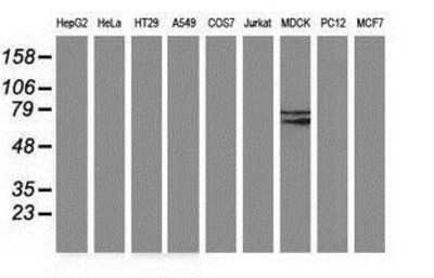 Western Blot: Butyrylcholinesterase/BCHE Antibody (OTI1E1) [NBP2-03523]