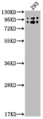 Western Blot: Butyrylcholinesterase/BCHE Antibody (1E9) [NBP3-15164]