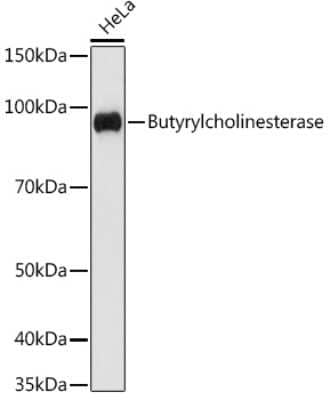 Western Blot: Butyrylcholinesterase/BCHE Antibody (4N2N9) [NBP3-16712]