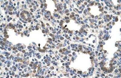 Immunohistochemistry-Paraffin: Butyrylcholinesterase/BCHE Antibody [NBP1-69541]
