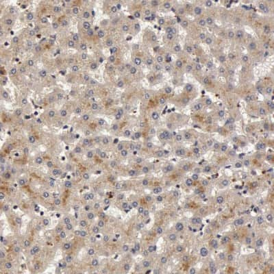 Immunohistochemistry-Paraffin: Butyrylcholinesterase/BCHE Antibody [NBP1-85633]