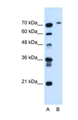 Western Blot: Butyrylcholinesterase/BCHE Antibody [NBP1-69541]