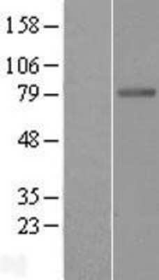 Western Blot: Butyrylcholinesterase/BCHE Overexpression Lysate [NBL1-07942]