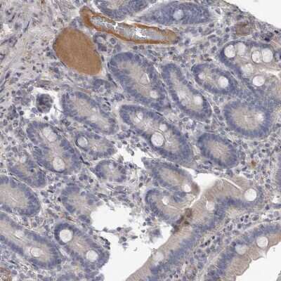 Immunohistochemistry-Paraffin: C-Reactive Protein/CRP Antibody [NBP1-87184]