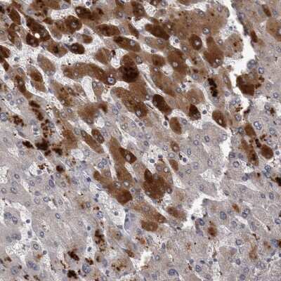Immunohistochemistry-Paraffin: C-Reactive Protein/CRP Antibody [NBP1-87184]