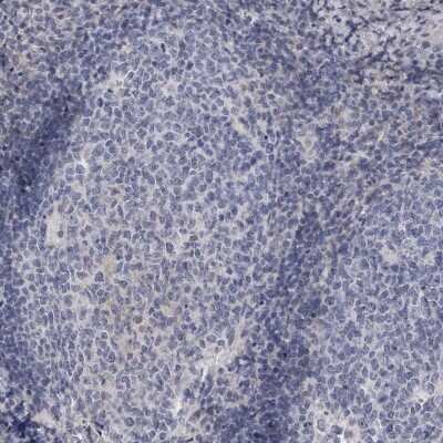 Immunohistochemistry-Paraffin: C-Reactive Protein/CRP Antibody [NBP1-87184]