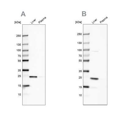 Western Blot: C-Reactive Protein/CRP Antibody [NBP1-87183]