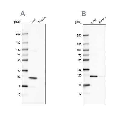 Western Blot: C-Reactive Protein/CRP Antibody [NBP1-87184]