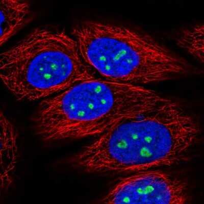 Immunocytochemistry/ Immunofluorescence: C-myc promoter-binding protein Antibody [NBP2-49444]