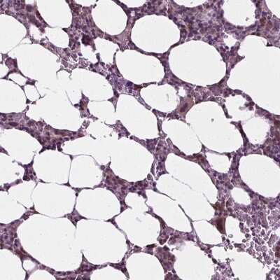 Immunohistochemistry-Paraffin: C-myc promoter-binding protein Antibody [NBP2-49444]
