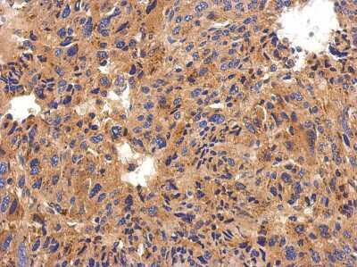 Immunohistochemistry-Paraffin: Serpin G1/C1 Inhibitor Antibody [NBP2-14892]