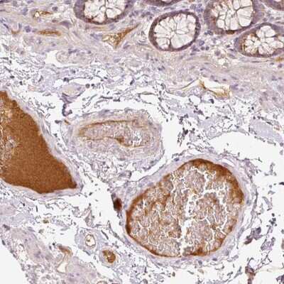 Immunohistochemistry-Paraffin: Serpin G1/C1 Inhibitor Antibody [NBP2-33536]