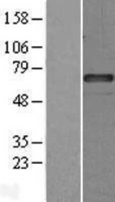 Western Blot: Serpin G1/C1 Inhibitor Overexpression Lysate [NBL1-15855]