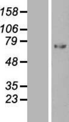 Western Blot: Serpin G1/C1 Inhibitor Overexpression Lysate [NBL1-15856]