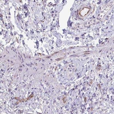Immunohistochemistry-Paraffin: DEPP1 Antibody [NBP2-38367]
