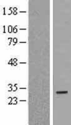 Western Blot: DEPP1 Overexpression Lysate [NBL1-08067]