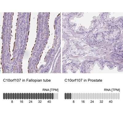 Immunohistochemistry-Paraffin: CABCOCO1 Antibody [NBP1-88738]