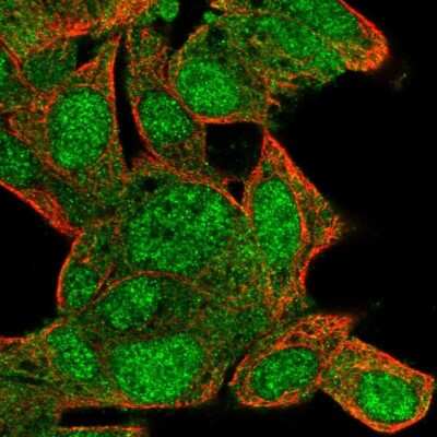Immunocytochemistry/ Immunofluorescence: LRMDA Antibody [NBP2-14802]