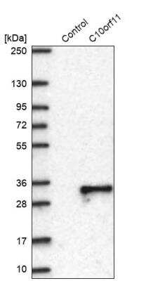 Western Blot: LRMDA Antibody [NBP2-14370]