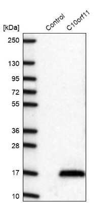 Western Blot: LRMDA Antibody [NBP2-14802]