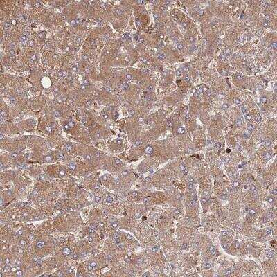 Immunohistochemistry-Paraffin: MALRD1 Antibody [NBP2-14578]