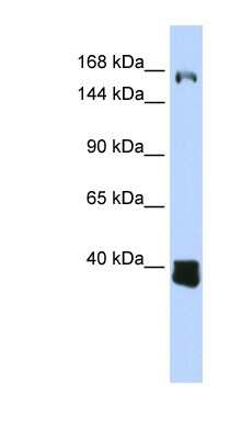 Western Blot: LCoR Antibody [NBP1-70426]