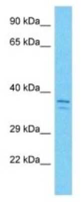 Western Blot: C10orf120 Antibody [NBP3-10757]