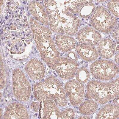 Immunohistochemistry-Paraffin: TMEM273 Antibody [NBP2-49275]