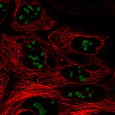 Immunocytochemistry/ Immunofluorescence: CC2D2B Antibody [NBP2-58030]