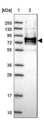 Immunohistochemistry: CC2D2B Antibody [NBP2-30772]