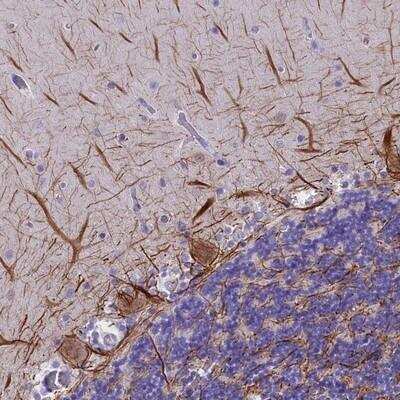 Immunohistochemistry-Paraffin: SKIDA1 Antibody [NBP1-81891]