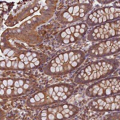 Immunohistochemistry-Paraffin: SKIDA1 Antibody [NBP1-81892]