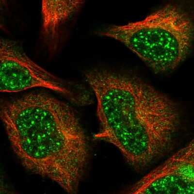 Immunocytochemistry/ Immunofluorescence: BORCS7 Antibody [NBP1-81912]