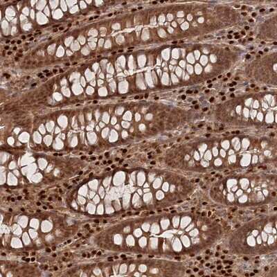 Immunohistochemistry-Paraffin: BORCS7 Antibody [NBP1-81912]