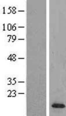 Western Blot: BORCS7 Overexpression Lysate [NBL1-08076]