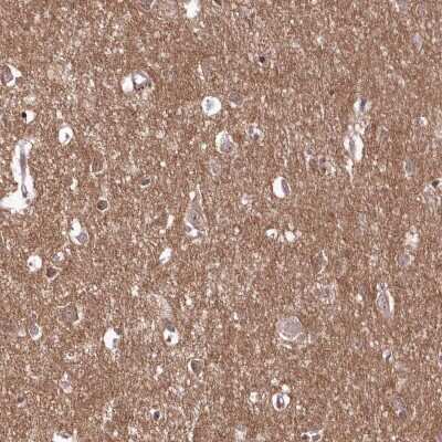 Immunohistochemistry-Paraffin: FAM241B Antibody [NBP1-86317]