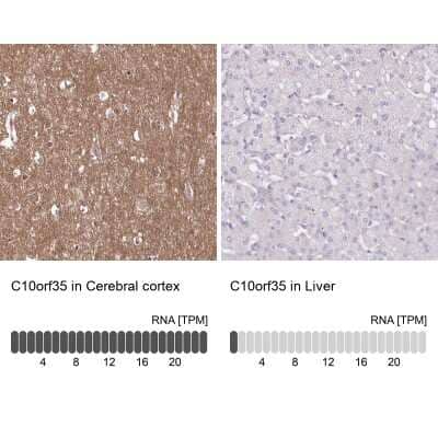 Immunohistochemistry-Paraffin: FAM241B Antibody [NBP1-86317]