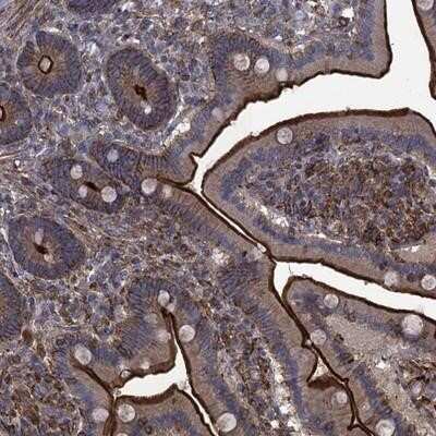 Immunohistochemistry-Paraffin: PROSER2 Antibody [NBP1-93477]