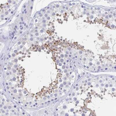 Immunohistochemistry-Paraffin: C10orf53 Antibody [NBP1-90476]
