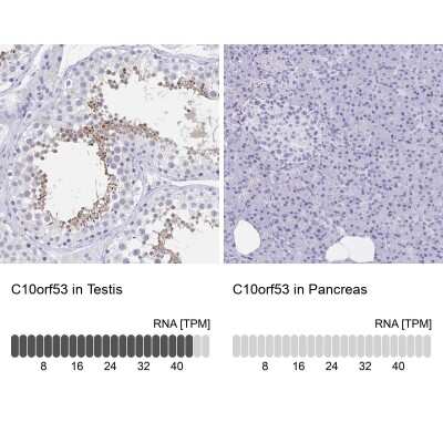 Immunohistochemistry-Paraffin: C10orf53 Antibody [NBP1-90476]