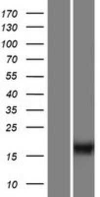 Western Blot: C10orf53 Overexpression Lysate [NBP2-04845]