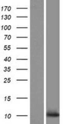 Western Blot: C10orf53 Overexpression Lysate [NBP2-08365]