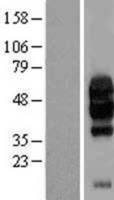 Western Blot: VISTA/B7-H5/PD-1H Overexpression Lysate [NBL1-08079]