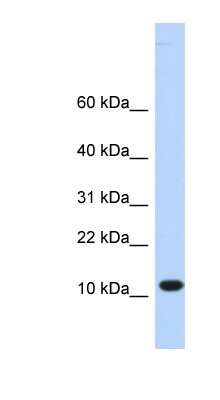 Western Blot: TMEM254 Antibody [NBP1-62316]