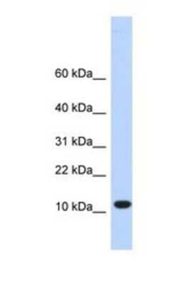 Western Blot: TMEM254 Antibody [NBP1-69342]